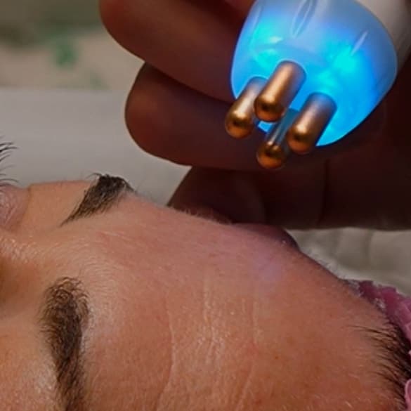 Hydro Glow+ RF Rejuv (3 Sessions) at Flawless Glow Esthetics in Fayetteville, GA